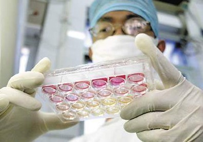 传染性非典型肺炎