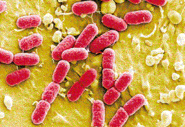 德国肠出血性大肠杆菌O104感染