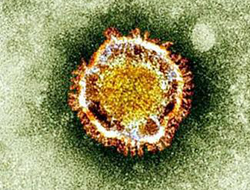 中东呼吸综合征